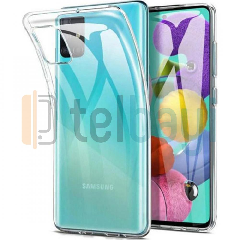 Samsung A01 Tpu Şeffaf Tıpalı Silikon Telefon Kapağı 